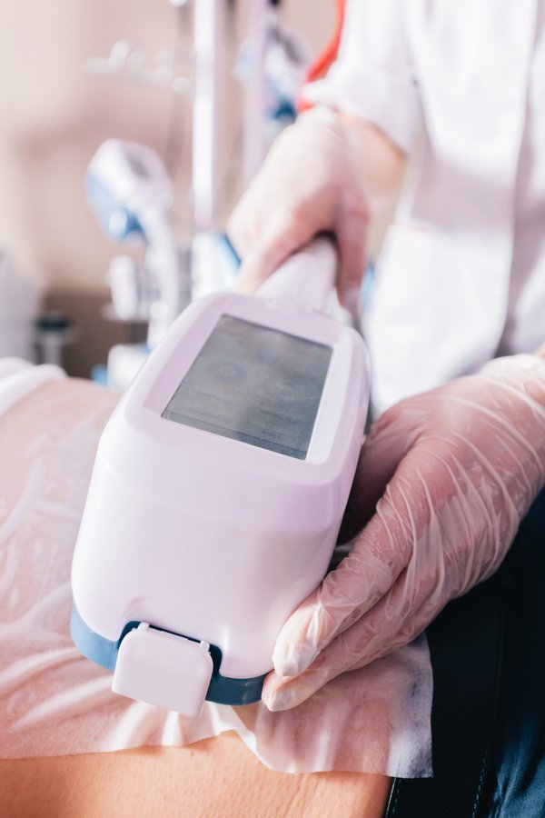 Découvrez 5 avantages de la cryolipolyse à nice